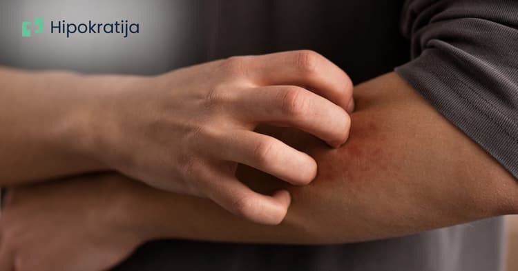 Ekcem na koži: kako izgleda, zašto se javlja i kako se leči