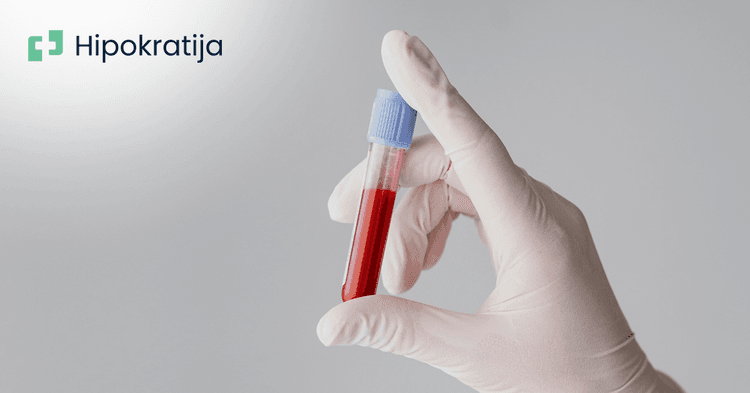 Hemofilija - ozbiljan poremećaj zgrušavanja krvi