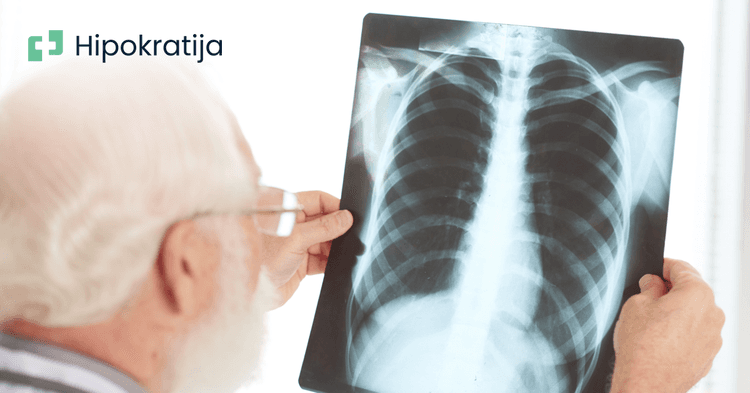 Tuberkuloza - sve što bi trebalo znati o ovoj zaraznoj bolesti